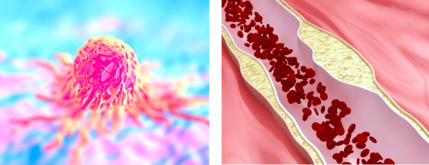 ガン細胞と血管