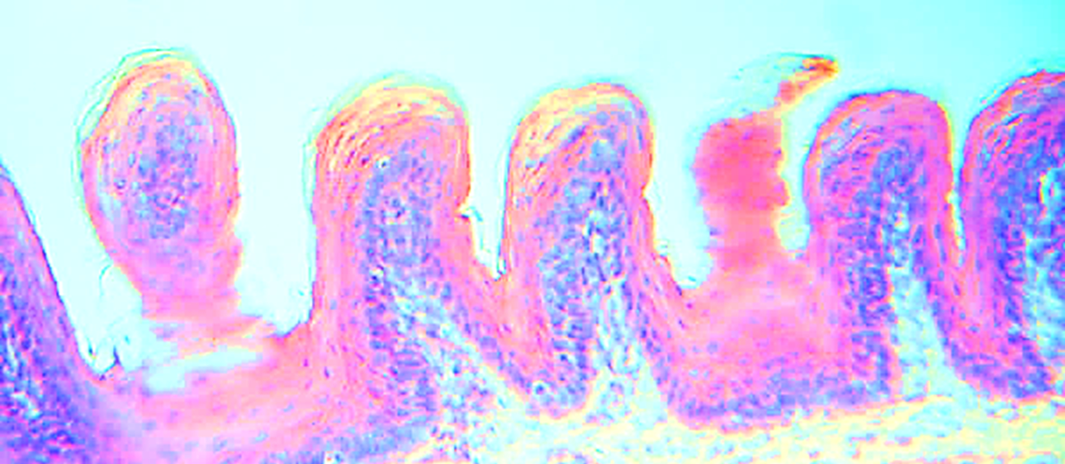 腸管上皮細胞